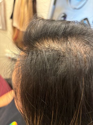 3 months of progress