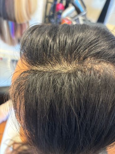 4 months of treatment