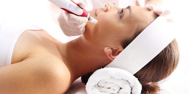 Dermapen therapy taken by a lady through a doctor