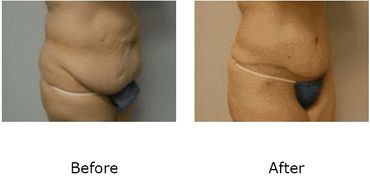 Leonard Tachmes MD PA