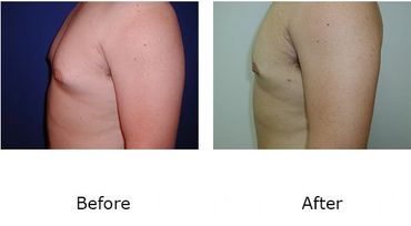 Leonard Tachmes MD PA