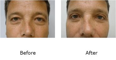 Leonard Tachmes MD PA