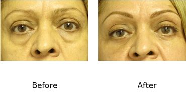 Leonard Tachmes MD PA