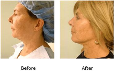 Leonard Tachmes MD PA