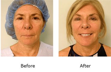 Leonard Tachmes MD PA