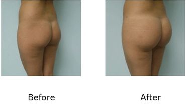 Leonard Tachmes MD PA