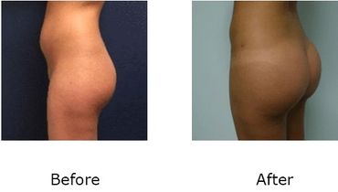 Leonard Tachmes MD PA