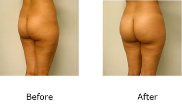 Leonard Tachmes MD PA