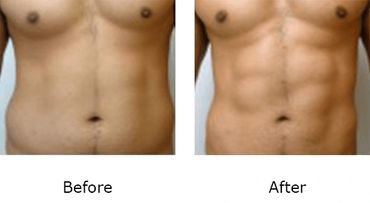 Leonard Tachmes MD PA