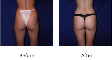 Leonard Tachmes MD PA