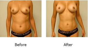 Leonard Tachmes MD PA