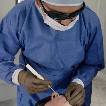 Tumescent Liposuction