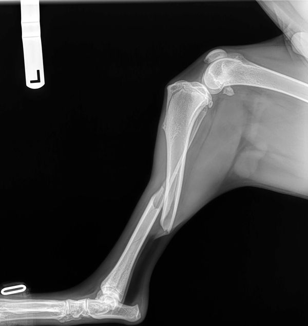 A fractured leg can be extremely painful but also limit the overall mobility of the patient.