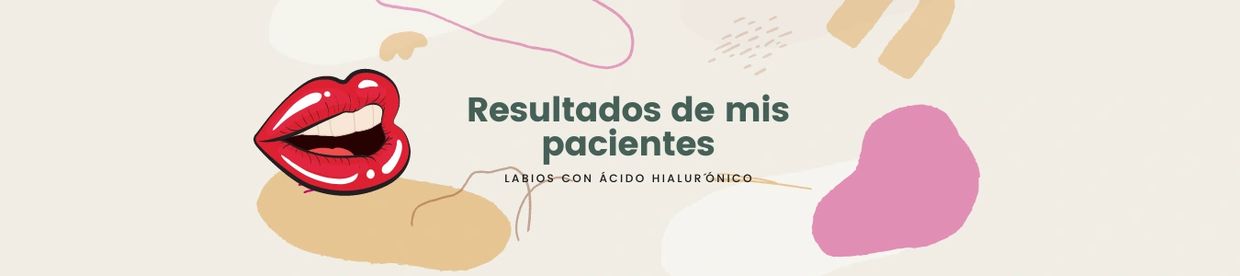 Labios perfectos con ácido hialurónico