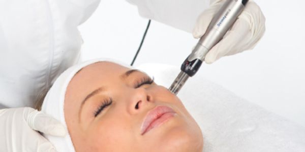 How does microneedling work? Facial Creation Spa in Tampa