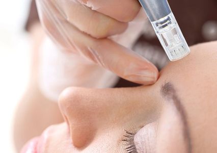 Procedure of microneedling in Facial Creation Spa Tampa Bay