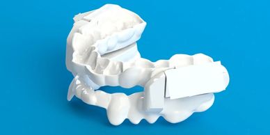 Our software has the ability to assist in dental appliance designs.