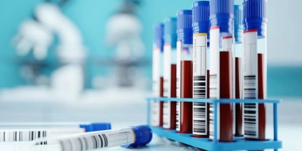 A row of human blood samples in a medical laboratory ready to be tested.