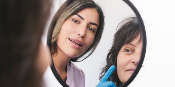 Client points at face areas to target  while laser technician assesses skin at Nanaimo clinic.