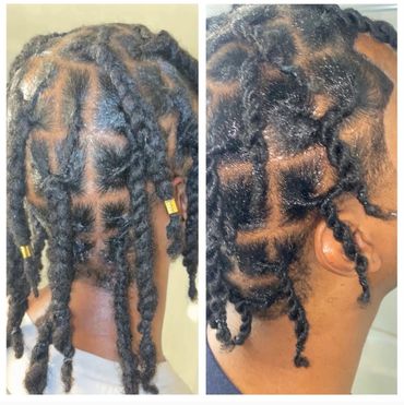 Close-up of the client’s hair growth process while using Rich Hair Growth Spray.