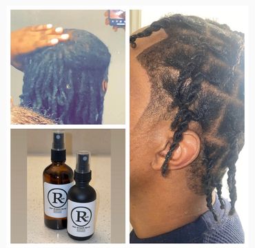 Before and after hair growth results with Rx Rich hair growth spray.
