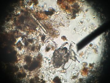 *ear mite under the microscope