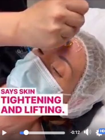 Social ad medical spa