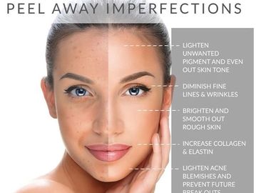 Experience the rejuvenation of a peel. We offer a range of peels to target your specific concern. 