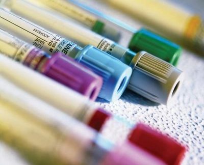 Minimally invasive sample type.