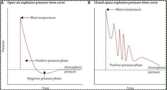 'Open' vs. 'closed' space blast exposure.