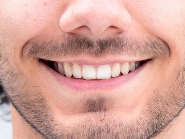 Lächelnder Mann mit schönen Zähnen nach Prothetik.