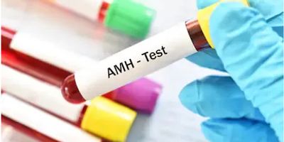 女性乌克兰试管代孕之重要检查-AMH检测