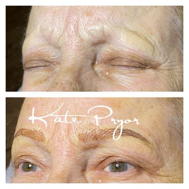 Before and after eyebrow enhancement on mature skin.