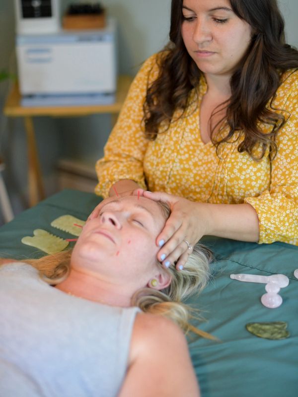 facial acupuncture treatment