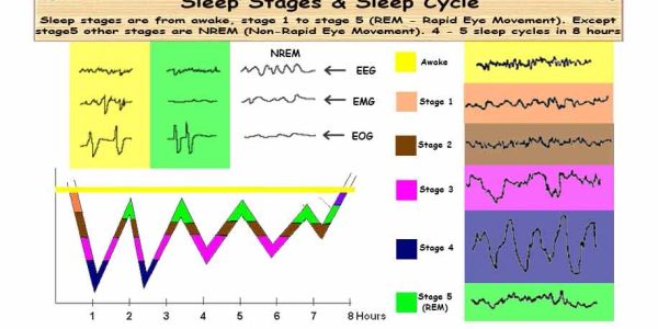 Uyku evreleri ve uyku döngüsünü gösteren grafik ve EEG, EMG, EOG kayıtları.