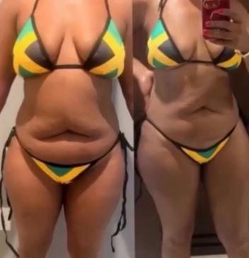 Before and after weight loss transformation in a bikini.