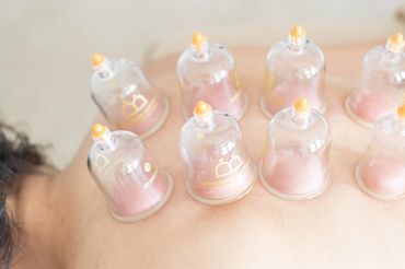 Cupping and Dry Needling available