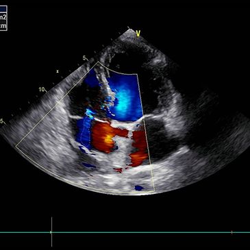 O exame de ultrassom é um método de diagnóstico por imagem que detecta doenças, Santos.