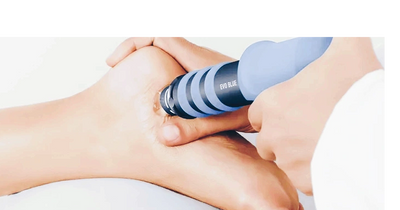 RADIO PULSE SHOCKWAVE THERAPY for foot pain 