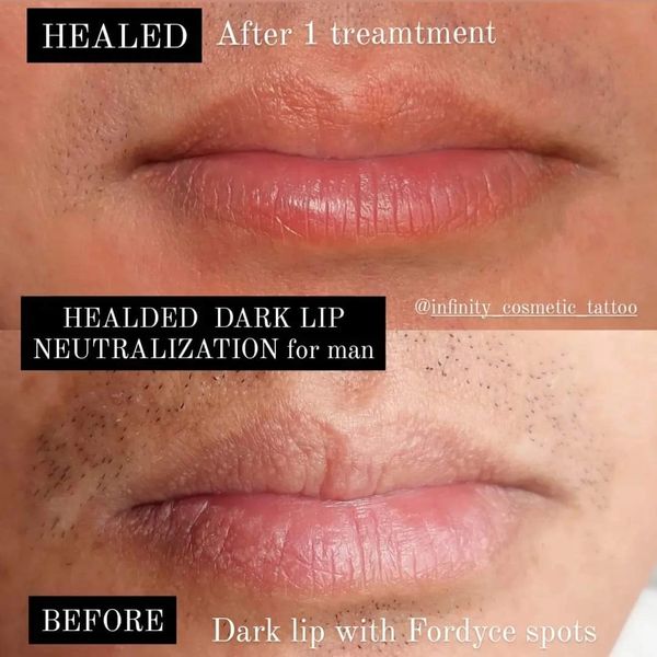 Healed lip blush tattoo gold coast man lip blush tattoo, lipblushing gold coast