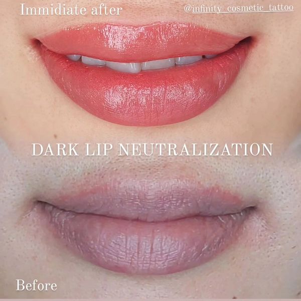 lip tattoo gold coast
dark lip neutralisation gold coast
lip blush tattoo gold coast
Lip blushing