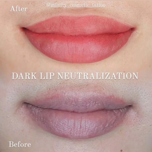lip tattoo gold coast
dark lip neutralisation gold coast
lip blush tattoo gold coast
Lip blushing