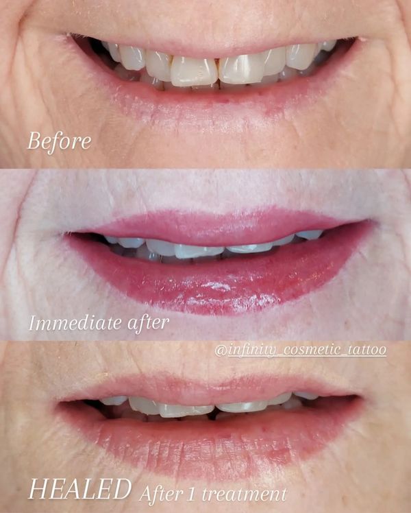 Lip blush tattoo gold coast
Lip blushing gold coast
Lip tattoo gold coast
Healed lip bluh tattoo
Lip