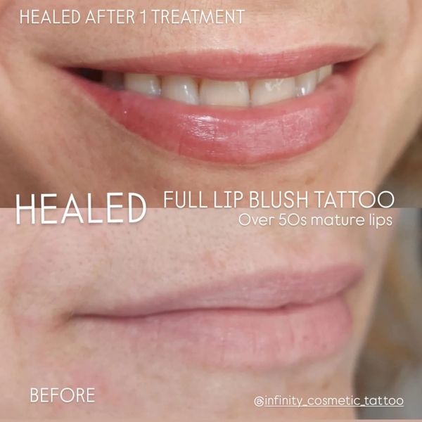 Lip blush tattoo gold coast
Lip blushing gold coast
Lip tattoo gold coast
Healed lip bluh tattoo
Lip