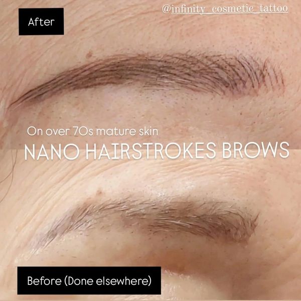Browfix goldcosst the best eyebrowtattoo gold oast eyebrow tattoo removal near me removery browundo