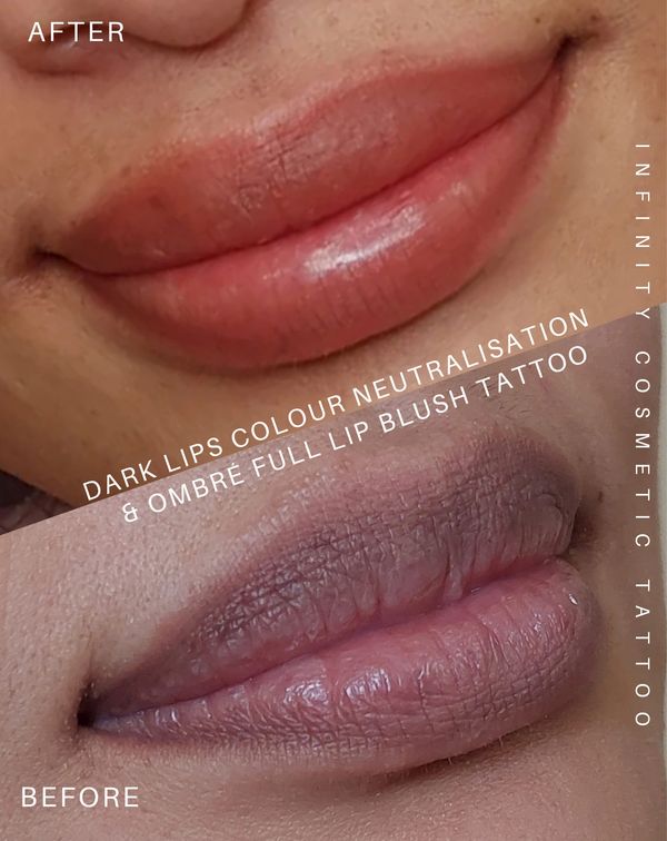 lip tattoo gold coast
dark lip neutralisation gold coast
lip blush tattoo gold coast
Lip blushing