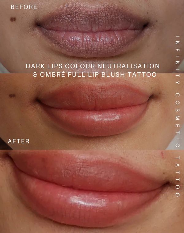 dark lip correction gold coast
dark lip neutralisation gold coast
dark lip blush tattoo gold coast