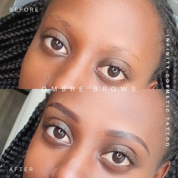 Eyebrow tattoo Gold Coast
Gold CoastEyebrow tattoo Gold Coast
Gold Coast eyebrow tattooing
Permanent