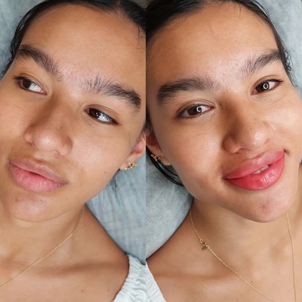 Lip tattoo near me
Lip blush tattoo gold coast
Datk lip lightening gold coast
Dark lipneutraluzation