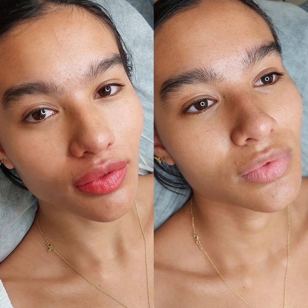 Lip tattoo near me
Lip blush tattoo gold coast
Datk lip lightening gold coast
Dark lipneutraluzation